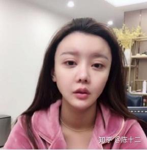 明星隆鼻材料